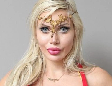 Αυτές οι γυναίκες λατρεύουν τις πλαστικές επεμβάσεις και μοιάζουν εξωπραγματικές (φωτό)